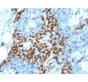 Immunohistochemistry - Anti-CD163 Antibody [M130/2164] (A250606) - Antibodies.com