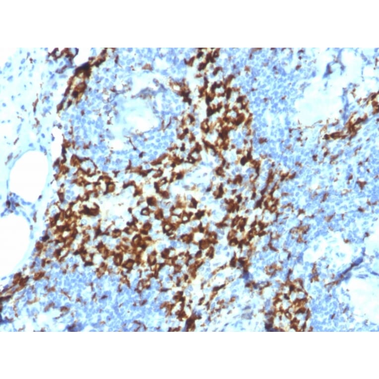 Immunohistochemistry - Anti-CD163 Antibody [M130/2164] (A250606) - Antibodies.com