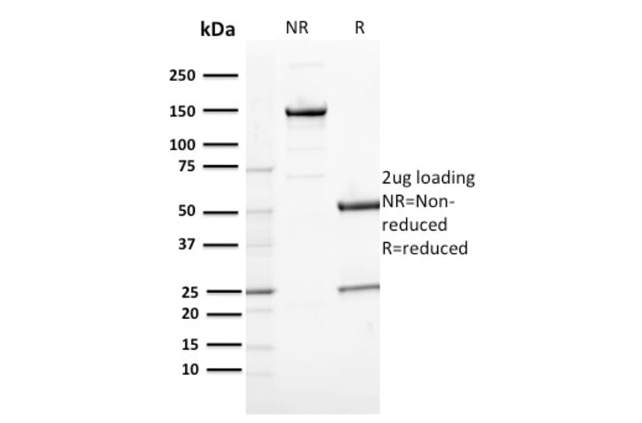 SDS-PAGE - Anti-CD163 Antibody [M130/2164] (A250606) - Antibodies.com