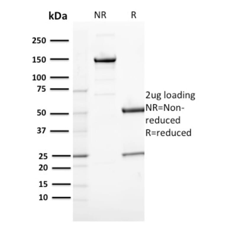 SDS-PAGE - Anti-CD163 Antibody [M130/2164] (A250606) - Antibodies.com