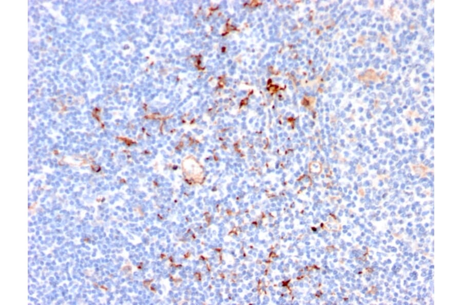 Immunohistochemistry - Anti-CD163 Antibody [M130/2164] (A250606) - Antibodies.com