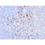 Immunohistochemistry - Anti-CD163 Antibody [M130/2164] (A250606) - Antibodies.com