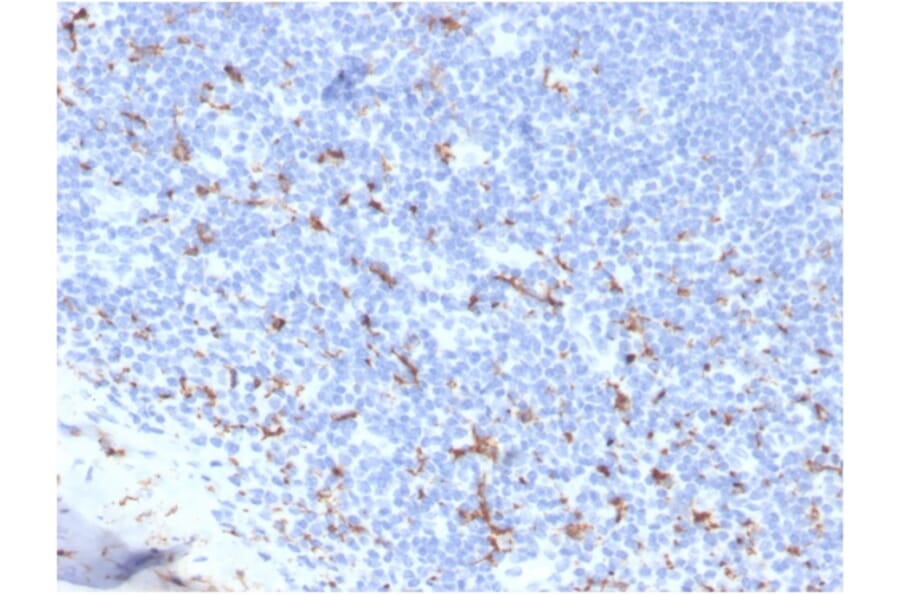 Immunohistochemistry - Anti-CD163 Antibody [M130/3708R] (A250607) - Antibodies.com