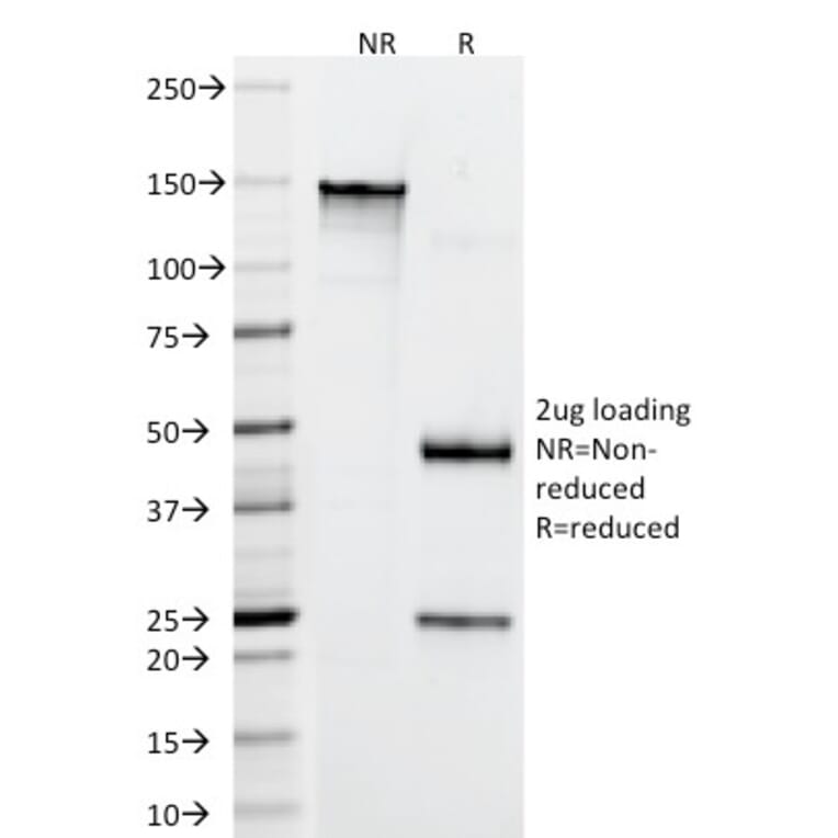 SDS-PAGE - Anti-CD22 Antibody [FR10B4] (A250607) - Antibodies.com