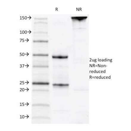SDS-PAGE - Anti-CD22 Antibody [MYG13] (A250609) - Antibodies.com