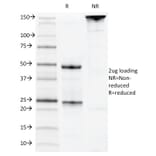 SDS-PAGE - Anti-CD22 Antibody [MYG13] (A250609) - Antibodies.com
