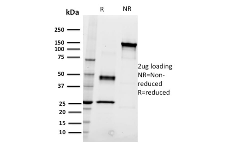SDS-PAGE - Anti-CD22 Antibody [RFB4] (A250610) - Antibodies.com