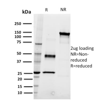 SDS-PAGE - Anti-CD22 Antibody [RFB4] (A250610) - Antibodies.com