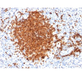 Immunohistochemistry - Anti-CD22 Antibody [BLCAM/1795] (A250611) - Antibodies.com