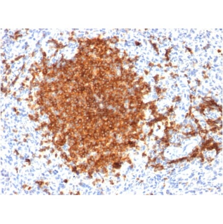 Immunohistochemistry - Anti-CD22 Antibody [BLCAM/1795] (A250611) - Antibodies.com