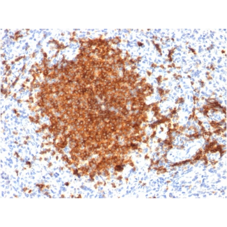 Immunohistochemistry - Anti-CD22 Antibody [BLCAM/1795] (A250611) - Antibodies.com