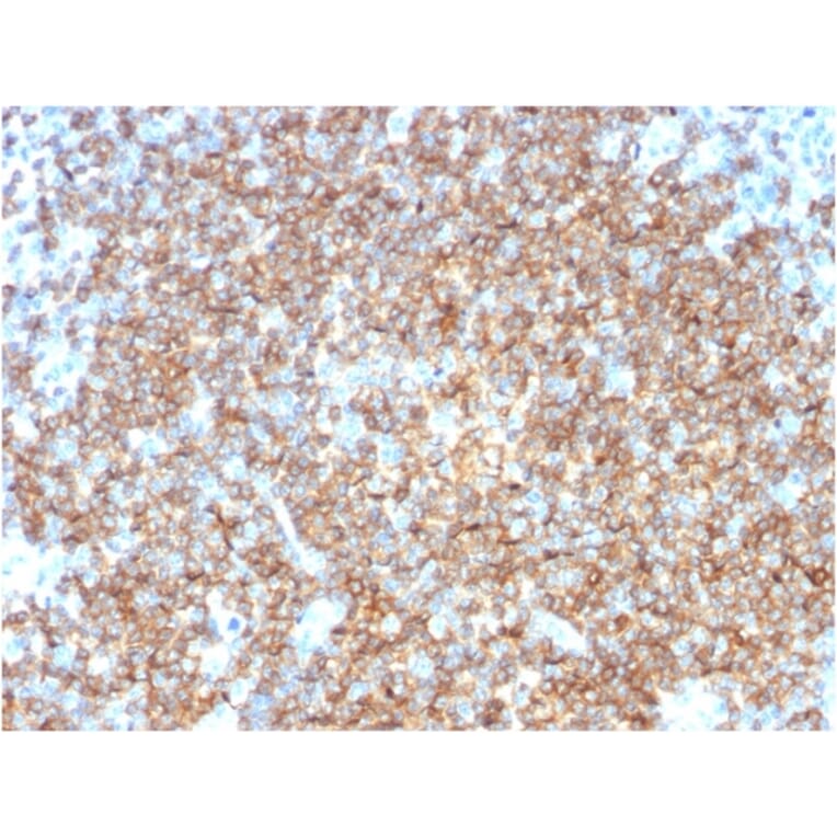 Immunohistochemistry - Anti-CD22 Antibody [BLCAM/1795] (A250611) - Antibodies.com