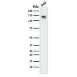 Western Blot - Anti-CD22 Antibody [BLCAM/1795] (A250611) - Antibodies.com