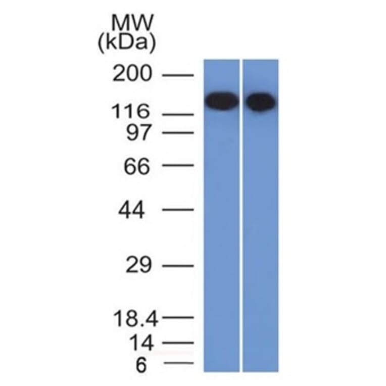 Western Blot - Anti-CD22 Antibody [BLCAM/1795] (A250611) - Antibodies.com