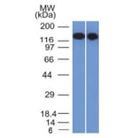 Western Blot - Anti-CD22 Antibody [BLCAM/1795] (A250611) - Antibodies.com