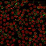 Immunofluorescence - Anti-CD22 Antibody [BLCAM/1795] (A250611) - Antibodies.com