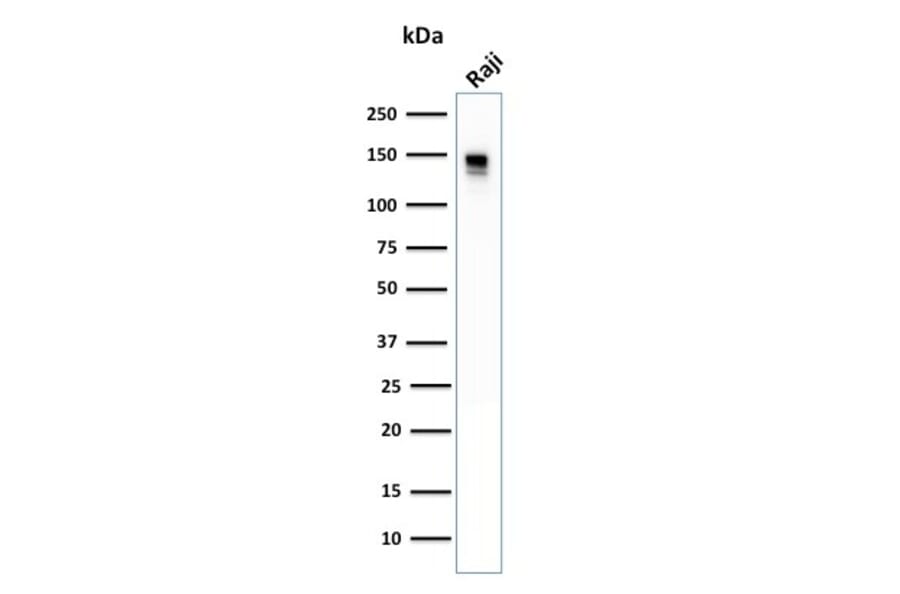 Western Blot - Anti-CD22 Antibody [BLCAM/1796] (A250612) - Antibodies.com