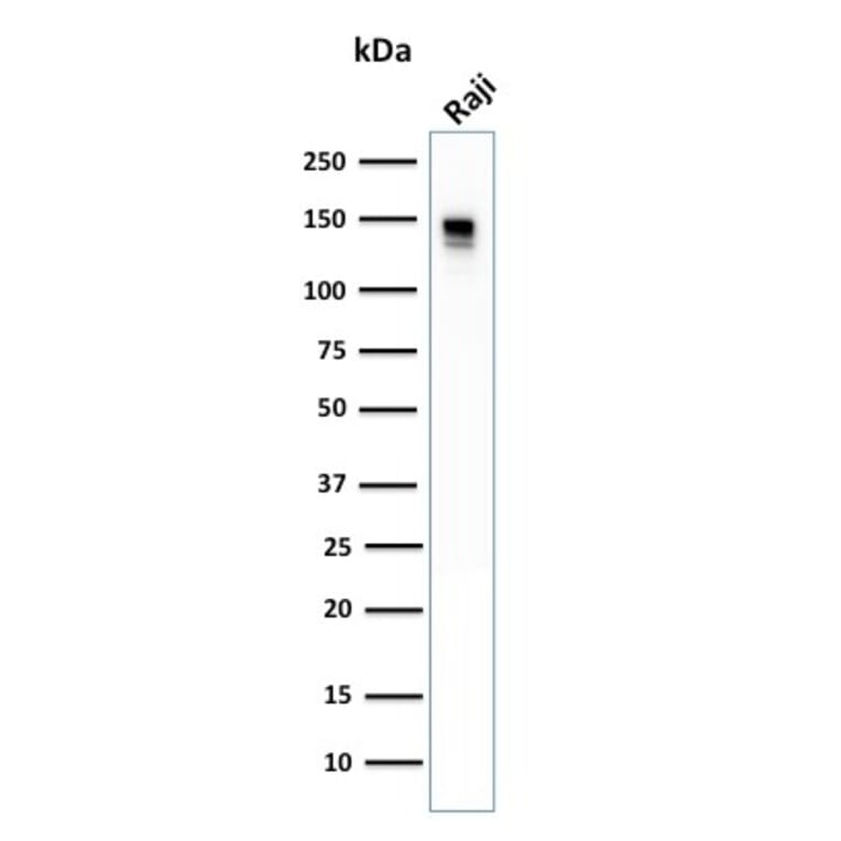 Western Blot - Anti-CD22 Antibody [BLCAM/1796] (A250612) - Antibodies.com