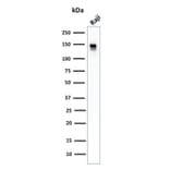 Western Blot - Anti-CD22 Antibody [BLCAM/1796] (A250612) - Antibodies.com