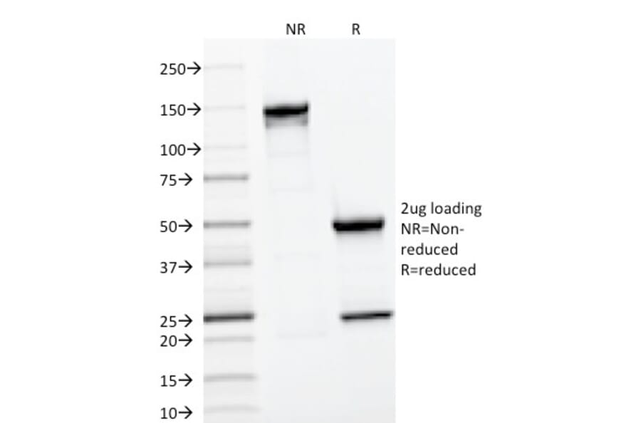 SDS-PAGE - Anti-CD22 Antibody [BLCAM/1796] (A250612) - Antibodies.com