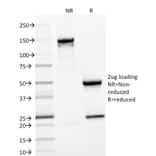 SDS-PAGE - Anti-CD22 Antibody [BLCAM/1796] (A250612) - Antibodies.com