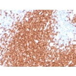 Immunohistochemistry - Anti-CD22 Antibody [rBLCAM/4108] (A250612) - Antibodies.com