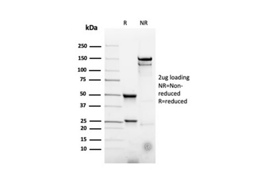 SDS-PAGE - Anti-CD22 Antibody [rBLCAM/4108] (A250613) - Antibodies.com
