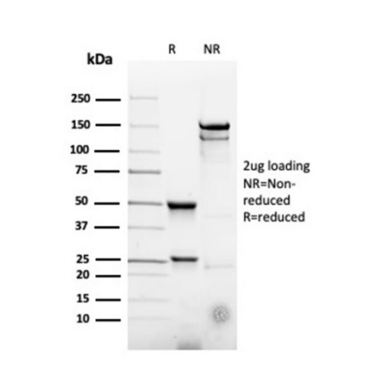 SDS-PAGE - Anti-CD22 Antibody [rBLCAM/4108] (A250613) - Antibodies.com