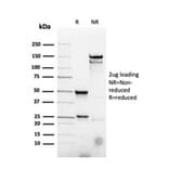 SDS-PAGE - Anti-CD22 Antibody [rBLCAM/4108] (A250613) - Antibodies.com