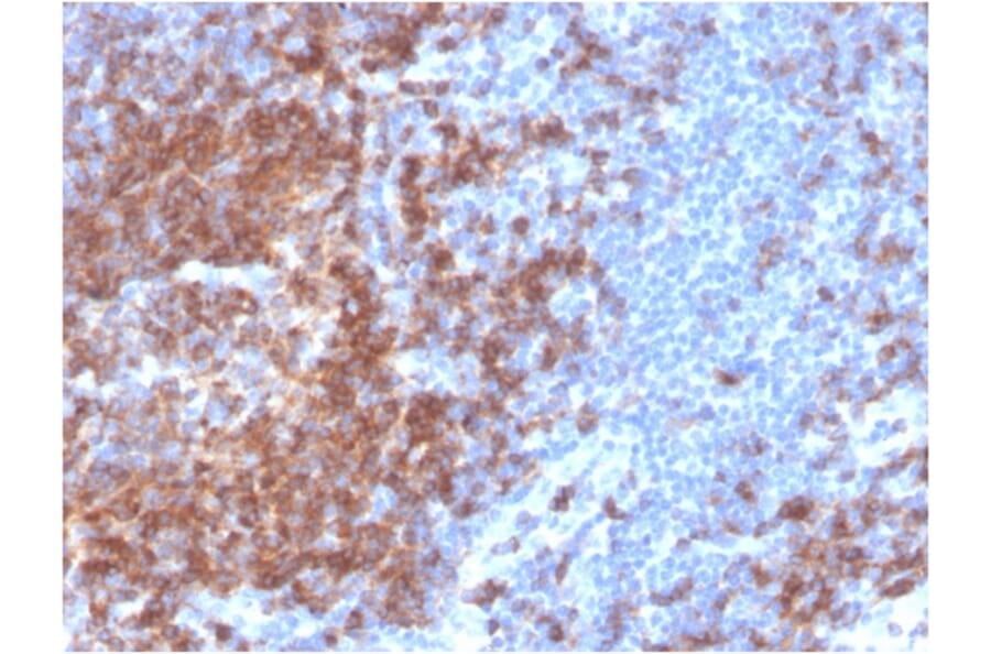 Immunohistochemistry - Anti-CD22 Antibody [BLCAM/2637R] (A250613) - Antibodies.com
