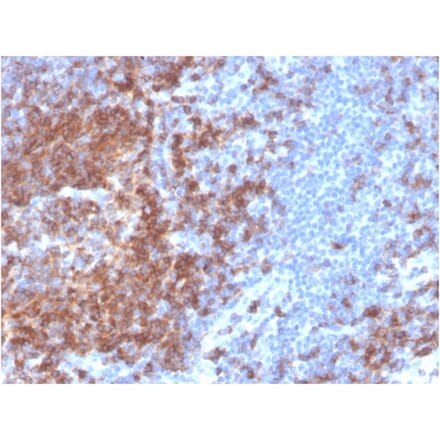 Immunohistochemistry - Anti-CD22 Antibody [BLCAM/2637R] (A250613) - Antibodies.com