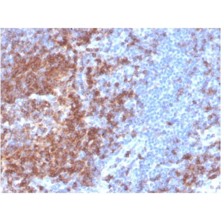 Immunohistochemistry - Anti-CD22 Antibody [BLCAM/2637R] (A250613) - Antibodies.com