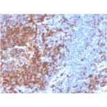 Immunohistochemistry - Anti-CD22 Antibody [BLCAM/2637R] (A250613) - Antibodies.com