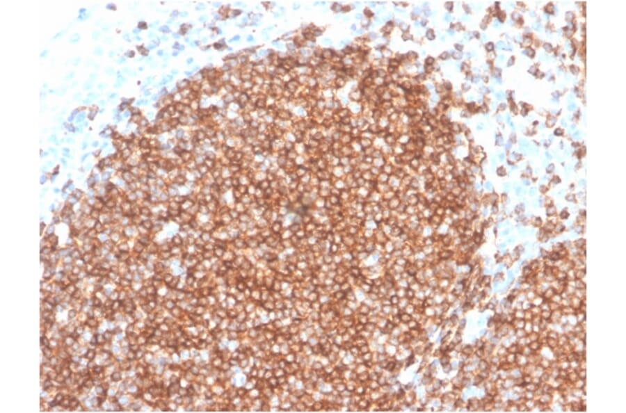 Immunohistochemistry - Anti-CD22 Antibody [BLCAM/2637R] (A250614) - Antibodies.com
