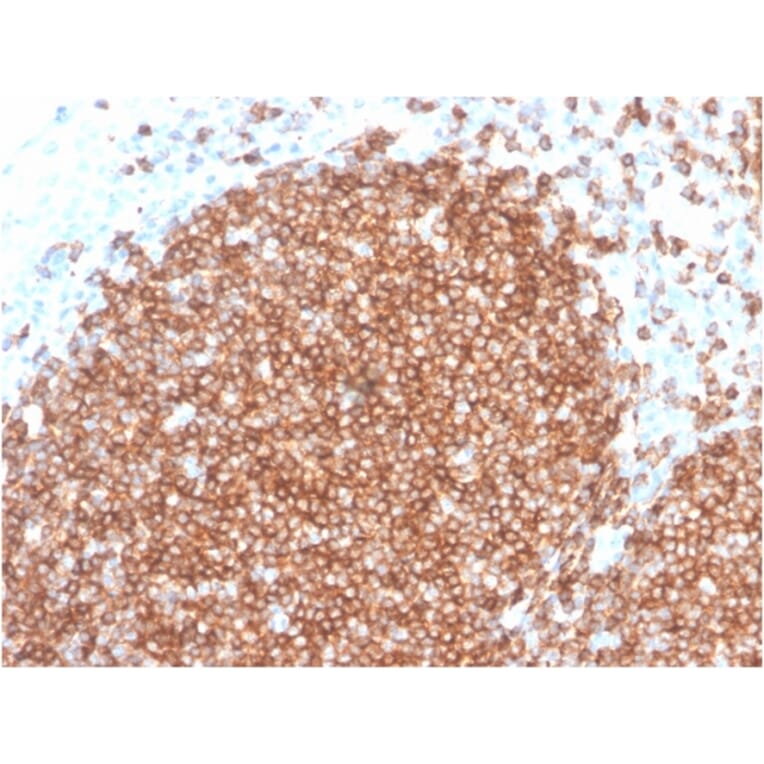 Immunohistochemistry - Anti-CD22 Antibody [BLCAM/2637R] (A250614) - Antibodies.com