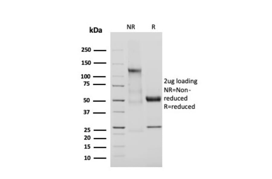 SDS-PAGE - Anti-Adiponectin Antibody [ADPN/4255] (A250615) - Antibodies.com