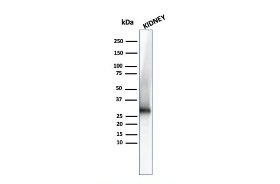 Western Blot - Anti-Adiponectin Antibody [ADPN/4255] (A250616) - Antibodies.com
