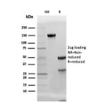 SDS-PAGE - Anti-Adiponectin Antibody [ADPN/4256] (A250617) - Antibodies.com