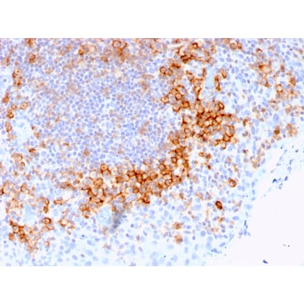 Immunohistochemistry - Anti-CD27 Antibody [LPFS2/1611] (A250619) - Antibodies.com