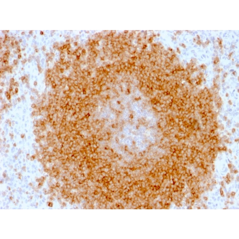 Immunohistochemistry - Anti-CD27 Antibody [LPFS2/1611] (A250619) - Antibodies.com