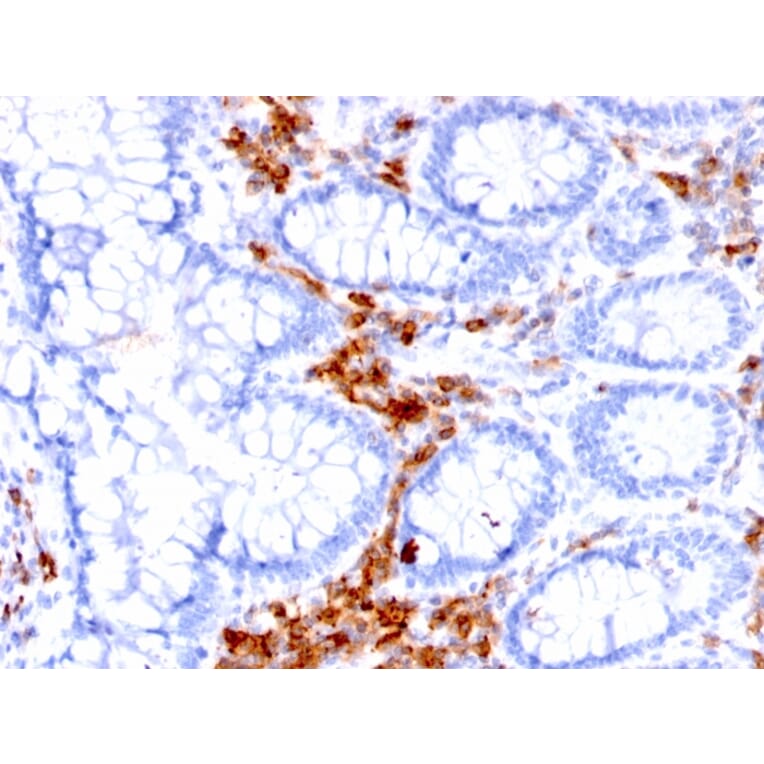 Immunohistochemistry - Anti-CD27 Antibody [LPFS2/1611] (A250619) - Antibodies.com