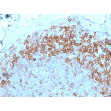 Immunohistochemistry - Anti-CD27 Antibody [LPFS2/4177] (A250621) - Antibodies.com