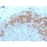 Immunohistochemistry - Anti-CD27 Antibody [LPFS2/4177] (A250621) - Antibodies.com