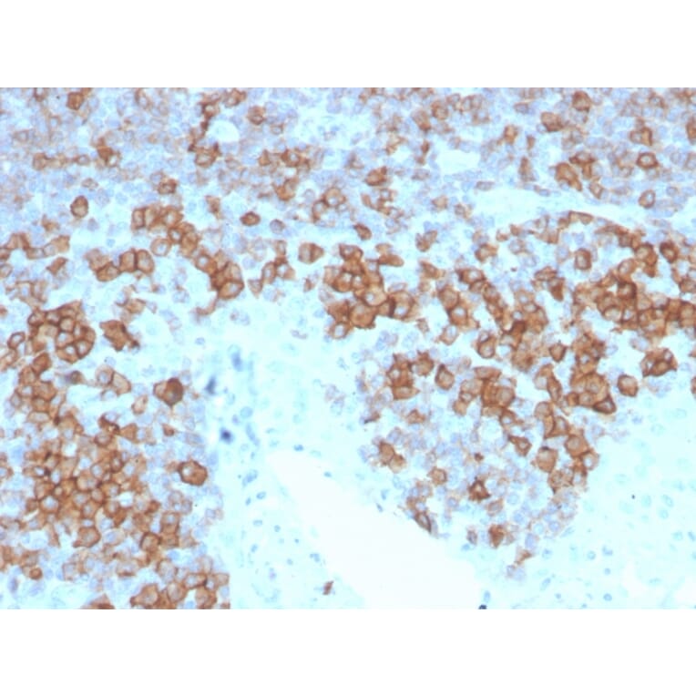 Immunohistochemistry - Anti-CD27 Antibody [LPFS2/4177] (A250621) - Antibodies.com