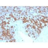 Immunohistochemistry - Anti-CD27 Antibody [LPFS2/4177] (A250621) - Antibodies.com