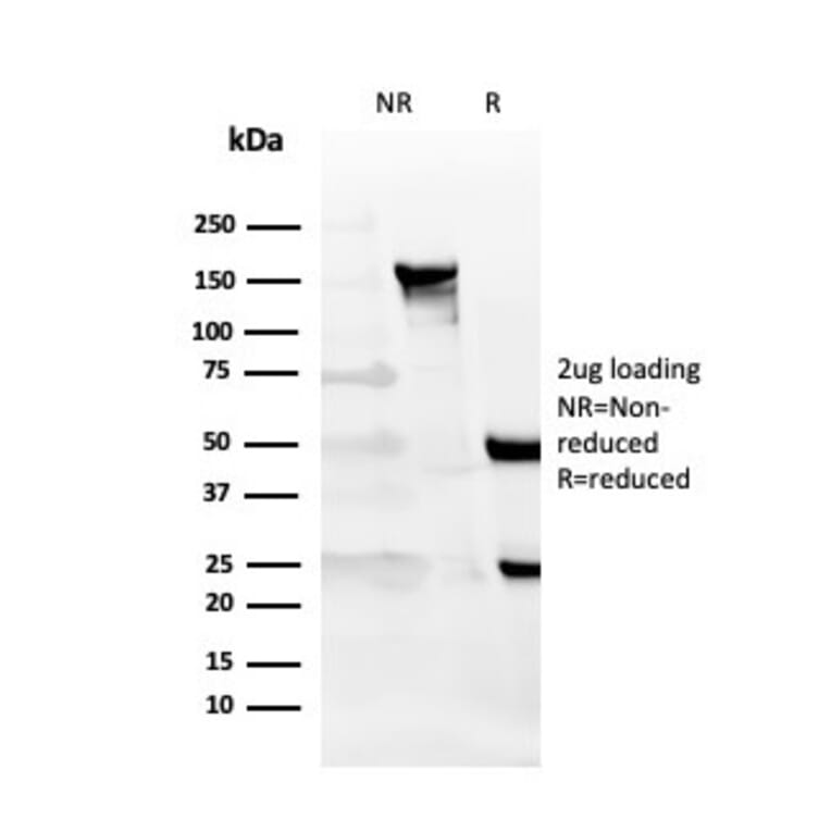 SDS-PAGE - Anti-CD27 Antibody [LPFS2/4177] (A250621) - Antibodies.com