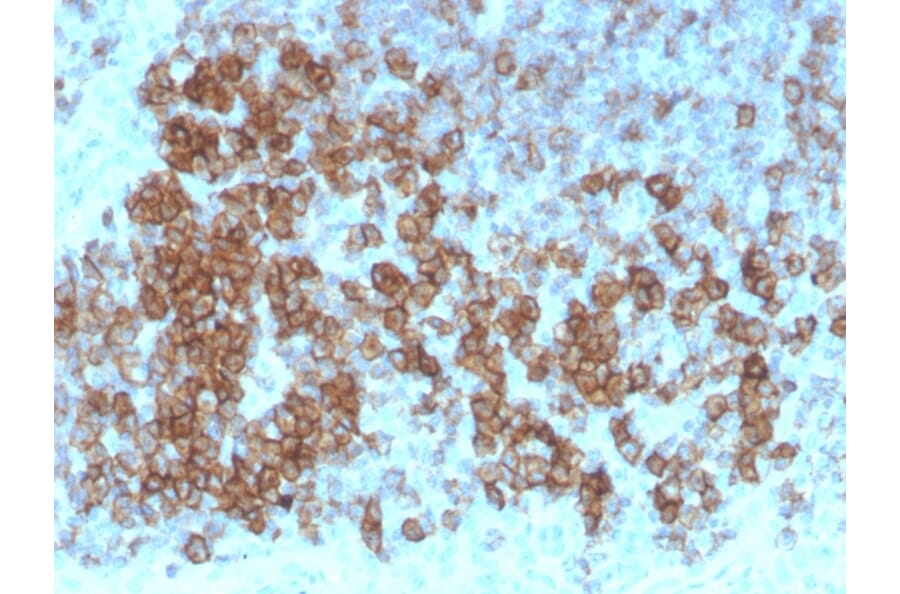 Immunohistochemistry - Anti-CD27 Antibody [LPFS2/4179] (A250622) - Antibodies.com