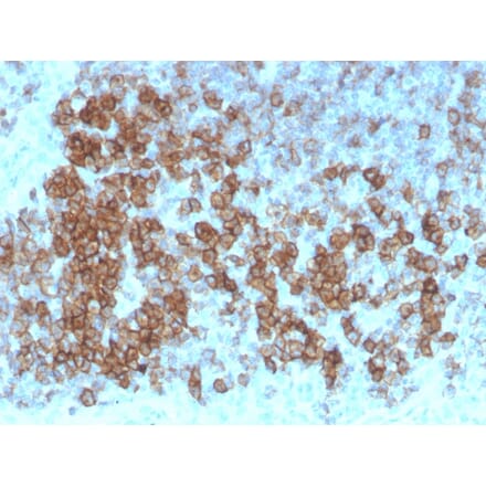 Immunohistochemistry - Anti-CD27 Antibody [LPFS2/4179] (A250622) - Antibodies.com