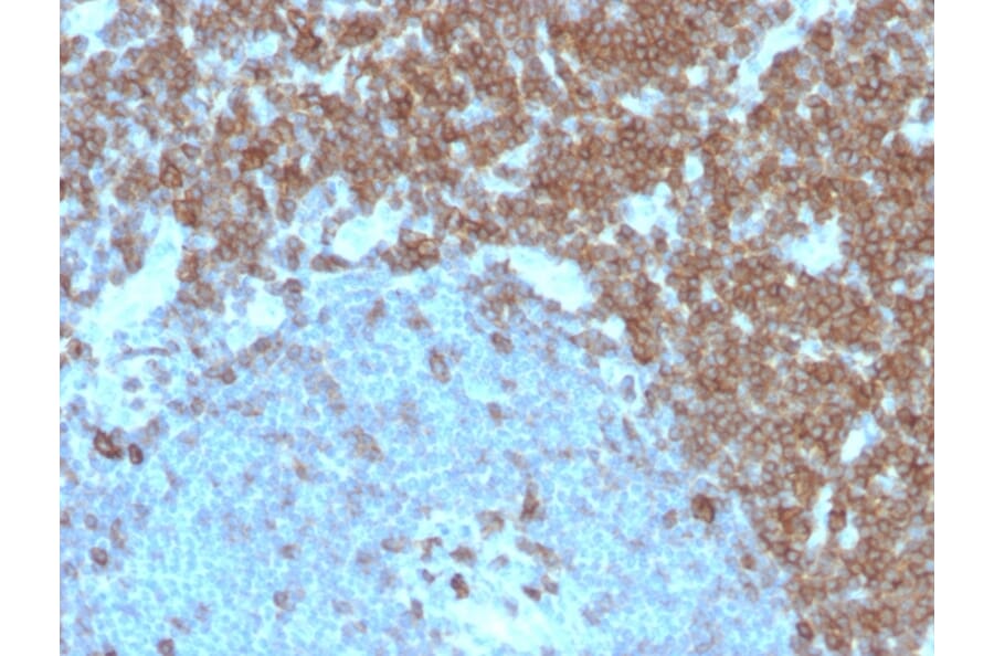 Immunohistochemistry - Anti-CD27 Antibody [LPFS2/4179] (A250622) - Antibodies.com