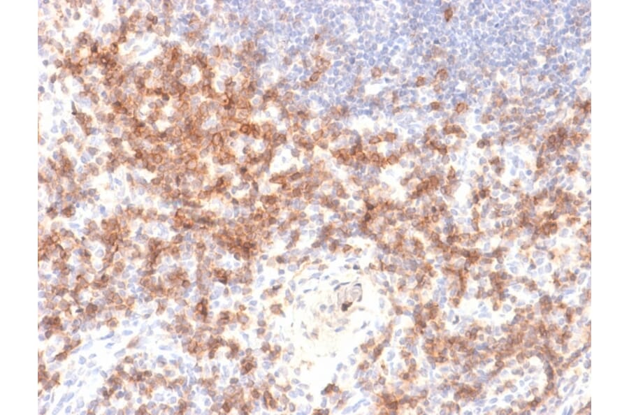 Immunohistochemistry - Anti-CD27 Antibody [LPFS2/2034R] (A250622) - Antibodies.com